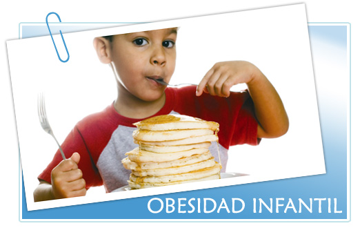 Obesidad infantil. Obesidad en los niños